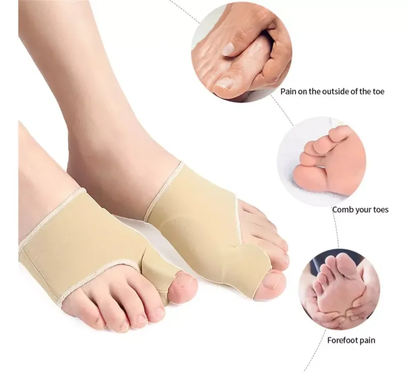 Comprar Par X2 Unidades Corrector De Juanete en Electroshopy - Ángulo 2